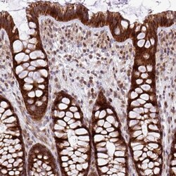 B3GNT9 Antibody, Novus Biologicals 25 &mu;L, Unlabeled:Antibodies, Polyclonal